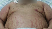 180-килограммовый мужчина несколько дней не замечал перелома позвоночника