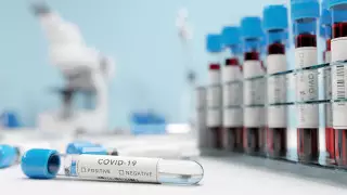 179 новых заболевших пневмонией обнаружили в Казахстане