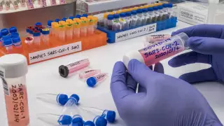 В Шымкенте и 4 областях не выявили новых зараженных коронавирусом