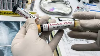 Кавасаки-подобный синдром встречается и у взрослых - медики