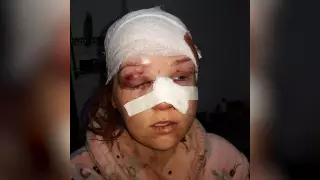 "Избивал молотком". Мужчину подозревают в нападении на бывшую жену в Шымкенте