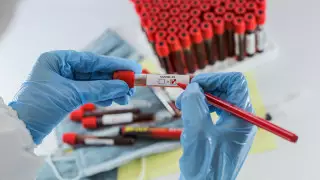 В Бразилии умер доброволец, получивший вакцину от коронавируса