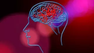 Названы факторы, резко повышающие риск развития инсульта