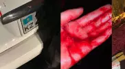 "Порезал меня" - алматинка рассказала о нападении в такси
