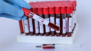 Новые случаи коронавирусной пневмонии зафиксировали в Казахстане