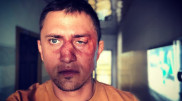 Избивший актера Павла Прилучного бизнесмен раскрыл подробности инцидента