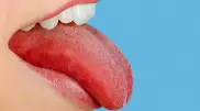 На какую опасную болезнь указывает покраснение языка - врачи