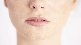 Назван необычный симптом рака