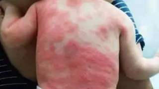 Фото "последствий вакцины от коронавируса" рассылают казахстанцы