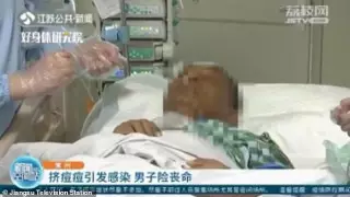 Мужчина выдавил прыщ на лице и оказался в реанимации