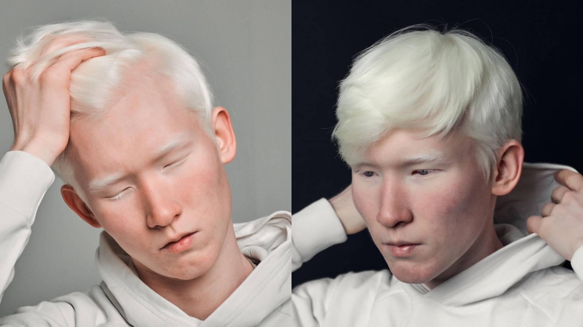 негр и азиат альбинос фото 44