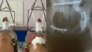 Отца ребенка, наехавшего на женщину с детьми, оштрафовали