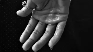 Потливость назвали признаком смертельно опасного состояния