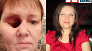"Ненадолго мне стало лучше, но потом начались адские боли"