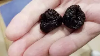 Назван сухофрукт, уменьшающий риск развития рака кишечника