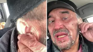 О состоянии обморозившего уши на трассе карагандинца рассказали медики