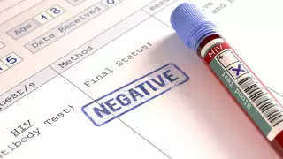 Группа людей в Африке смогла подавить ВИЧ - исследование