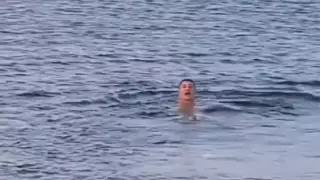 Доктор Мясников заболел опоясывающим лишаем и назначил себе экстремальное купание