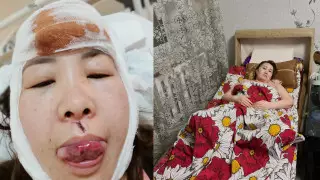 "Пытаются замять". Пострадавшие в ДТП пожаловались на следствие