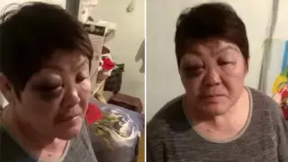 "Угрожал сжечь меня и детей". Женщина обвинила бывшего мужа в избиении в Алматинской области