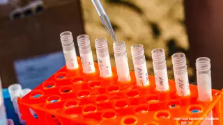 Ученые нашли ключевой биомаркер тяжелой формы COVID-19