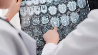 Названы семь способов замедлить старение мозга