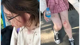 Мама избитой в поселке Боролдай девушки обратилась к казахстанцам