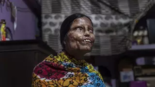 "Выжившая в кислотной атаке". Эмоциональные снимки конкурса All About Photo Awards