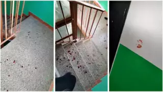 В полиции ЗКО прокомментировали сообщения об отрезанном половом органе