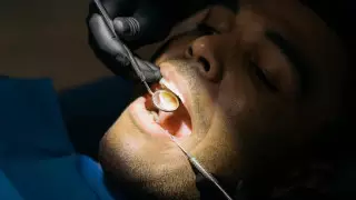 Врач предупредила о вреде отбеливания зубов: "Чем желтее – тем прочнее"