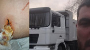 На работавшего для БАКАД водителя напали с ножом под Алматы