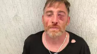 Избитый гомофобной группой оператор умер от передозировки наркотиками - МВД Грузии