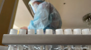 Свыше шести тысяч заболевших коронавирусом выявили в Казахстане за сутки