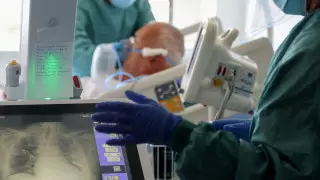 Разницу между привитыми и непривитыми заболевшими показали на рентген-снимке