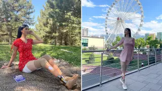 "Никто не догадывался, что я на протезах". Девушка без ног из Алматы покоряет TikTok