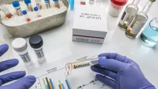 За использование поддельного ПЦР-теста на женщину в Таразе завели дело