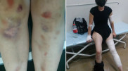 Полиция Алматы ответила на обвинение женщины в избиении
