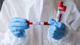 Ситуация с COVID-19 в Казахстане постепенно стабилизируется - Цой