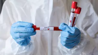 129 человек умерли от коронавируса и пневмонии в Казахстане