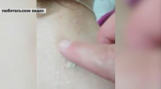 Вирусологи не смогли установить вид одолевших павлодарскую семью подкожных паразитов
