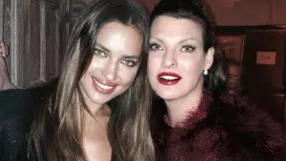 Знаменитую супермодель изуродовала косметическая процедура