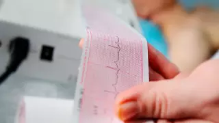 Казахстанские специалисты создали программу для расшифровки ЭКГ онлайн