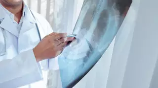 "Легкие становятся как тесто" - патологоанатом рассказал о последствиях коронавируса