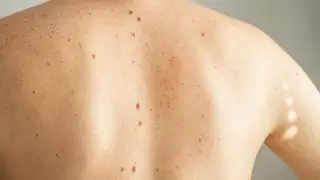 Названы ранние симптомы, требующие срочного обращения к онкологу