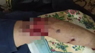 Вырвала кусок мяса из руки: собака напала на прохожего в Павлодарской области