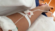 Ускоряющий выздоровление от COVID-19 витамин назвали ученые
