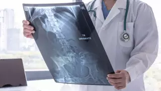 Ученые назвали два самых ранних симптома рака поджелудочной железы