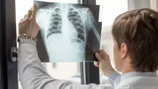 Врачи смогут прописывать электронные сигареты желающим бросить курить