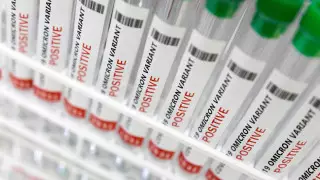 Названы причины рекордного роста заражений COVID-19 в Казахстане