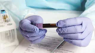 10 лет за 10 дней: биолог рассказал, как старит COVID-19